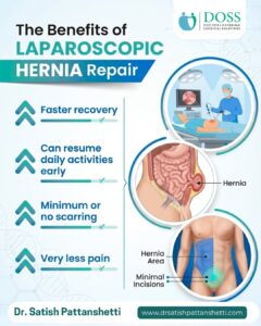 Laparoscopic Hernia Repair Surgery