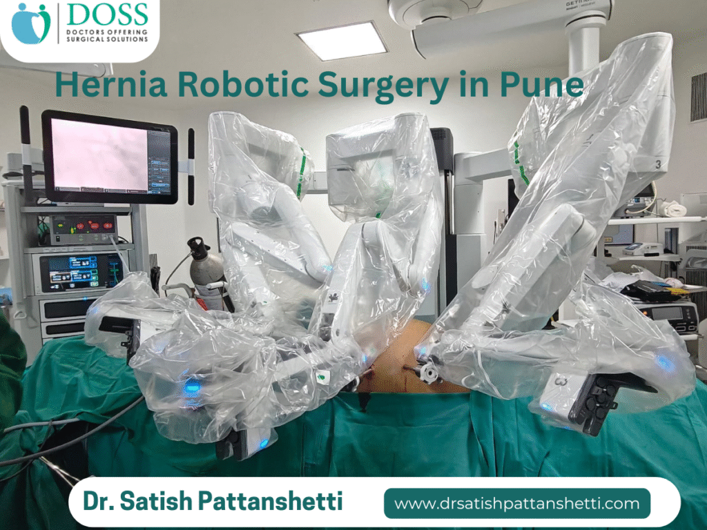 Hernia Robotic Surgery performed by Dr. Satish patanshett