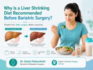 bariatric surgery in Pune